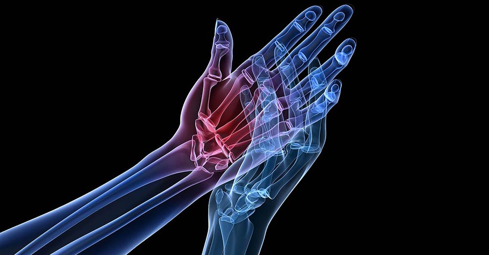 X-Ray Showing Pain in the Wrists