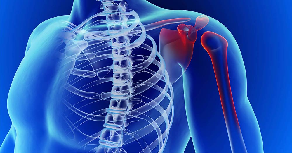 X-Ray Showing Pain in Shoulder