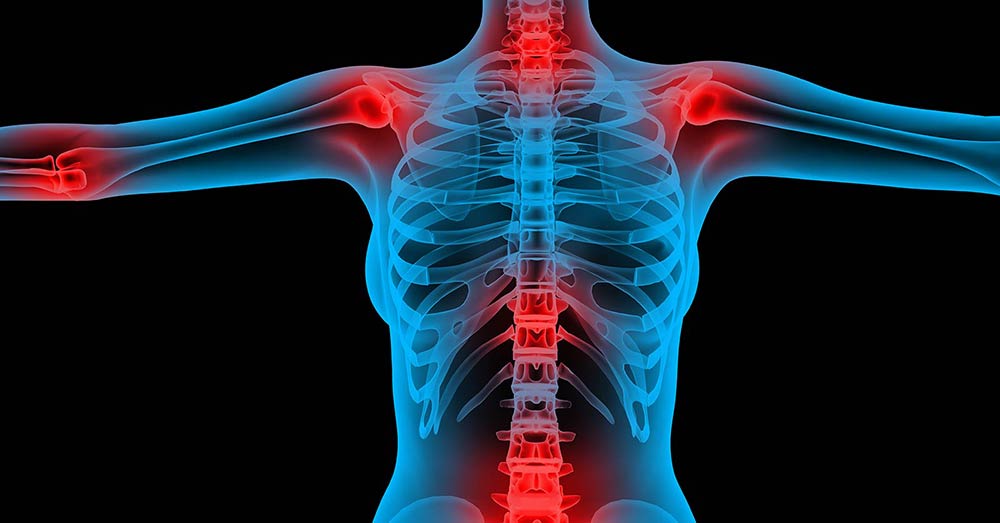 X-Ray Showing Pain Areas in the Body