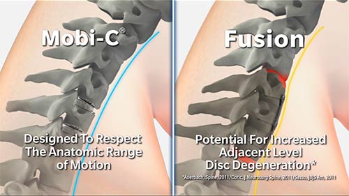 Mobi-C vs Fusion