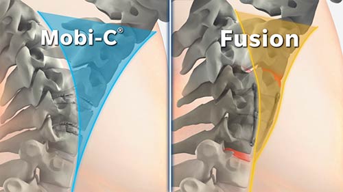 Mobi-C vs Fusion